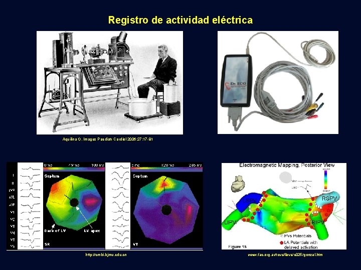 Registro de actividad eléctrica Aquilina O. Images Paediatr Cardiol 2006; 27: 17 -81 http: