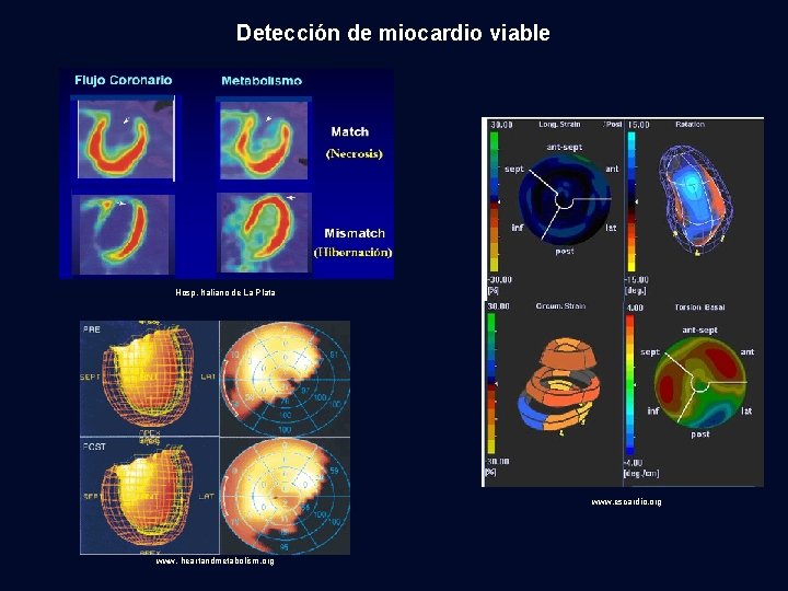 Detección de miocardio viable Hosp. Italiano de La Plata www. escardio. org www. heartandmetabolism.