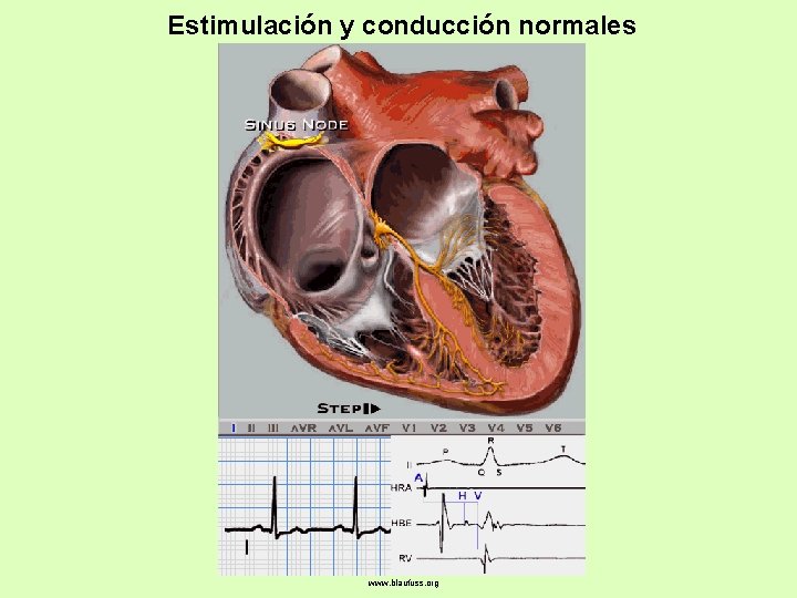 Estimulación y conducción normales www. blaufuss. org 