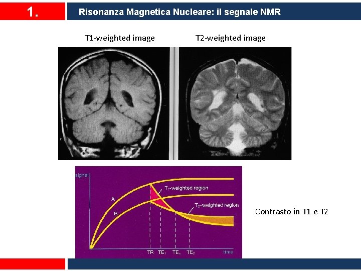 1. Risonanza Magnetica Nucleare: il segnale NMR T 1 -weighted image T 2 -weighted