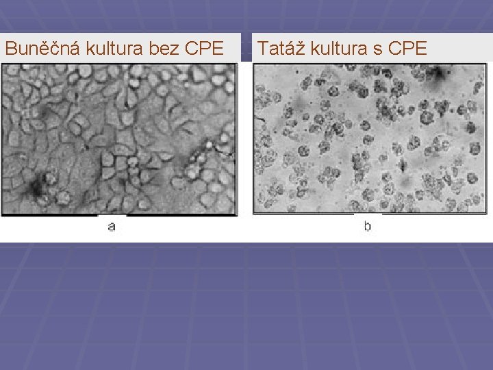 Buněčná kultura bez CPE Tatáž kultura s CPE 