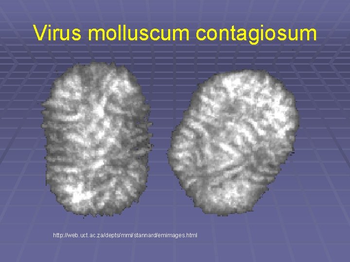 Virus molluscum contagiosum http: //web. uct. ac. za/depts/mmi/stannard/emimages. html 