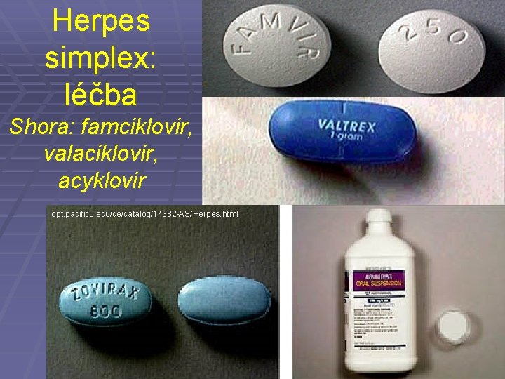 Herpes simplex: léčba Shora: famciklovir, valaciklovir, acyklovir opt. pacificu. edu/ce/catalog/14382 -AS/Herpes. html 