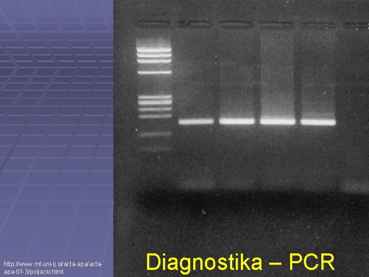 http: //www. mf. uni-lj. si/acta-apa/actaapa-01 -3/poljacki. html Diagnostika – PCR 