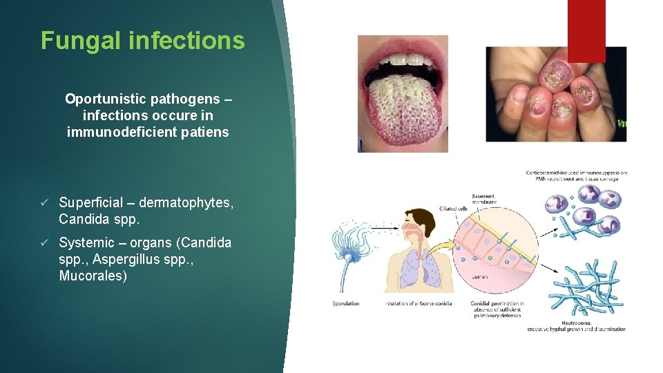 Fungal infections Oportunistic pathogens – infections occure in immunodeficient patiens ü Superficial – dermatophytes,