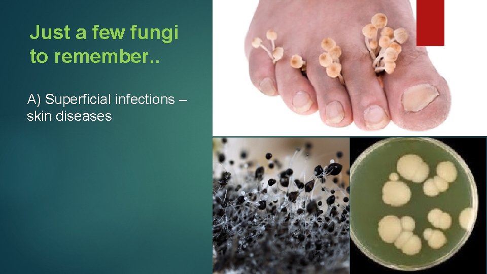 Just a few fungi to remember. . A) Superficial infections – skin diseases 