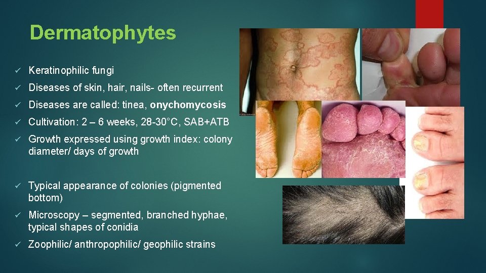 Dermatophytes ü Keratinophilic fungi ü Diseases of skin, hair, nails- often recurrent ü Diseases