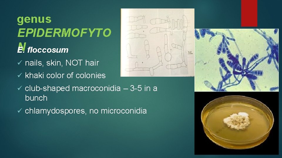 genus EPIDERMOFYTO N E. floccosum ü nails, skin, NOT hair ü khaki color of