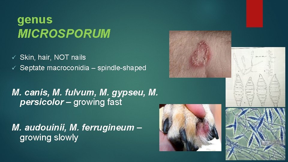 genus MICROSPORUM Skin, hair, NOT nails ü Septate macroconidia – spindle-shaped ü M. canis,