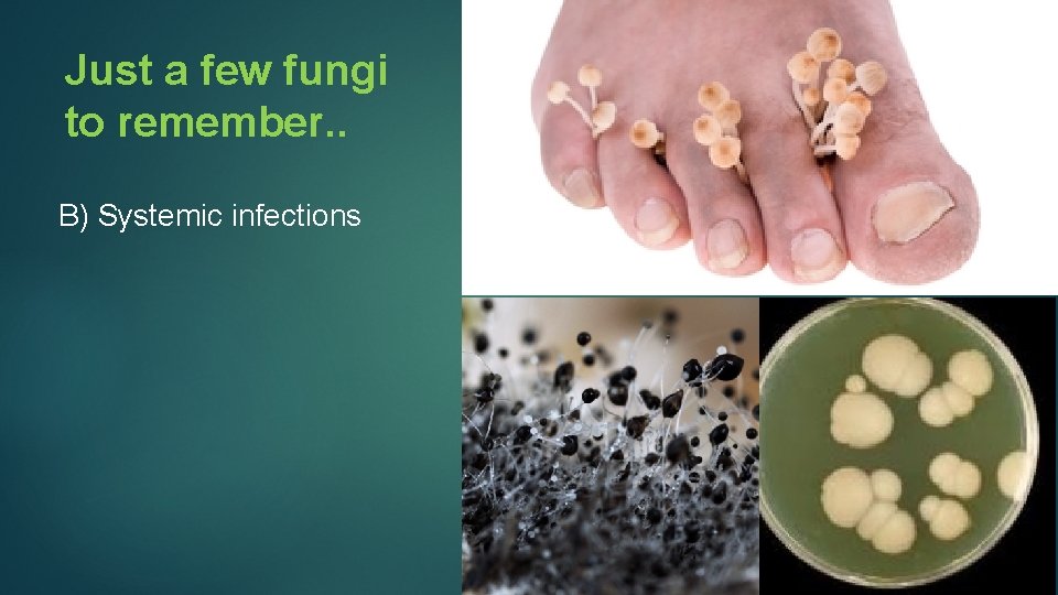 Just a few fungi to remember. . B) Systemic infections 