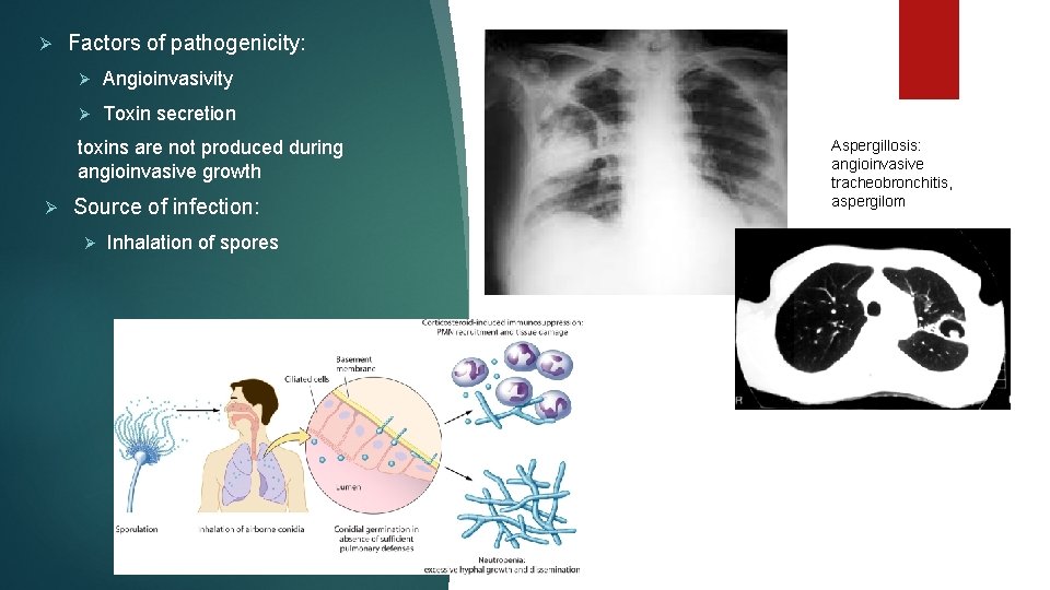 Ø Factors of pathogenicity: Ø Angioinvasivity Ø Toxin secretion toxins are not produced during