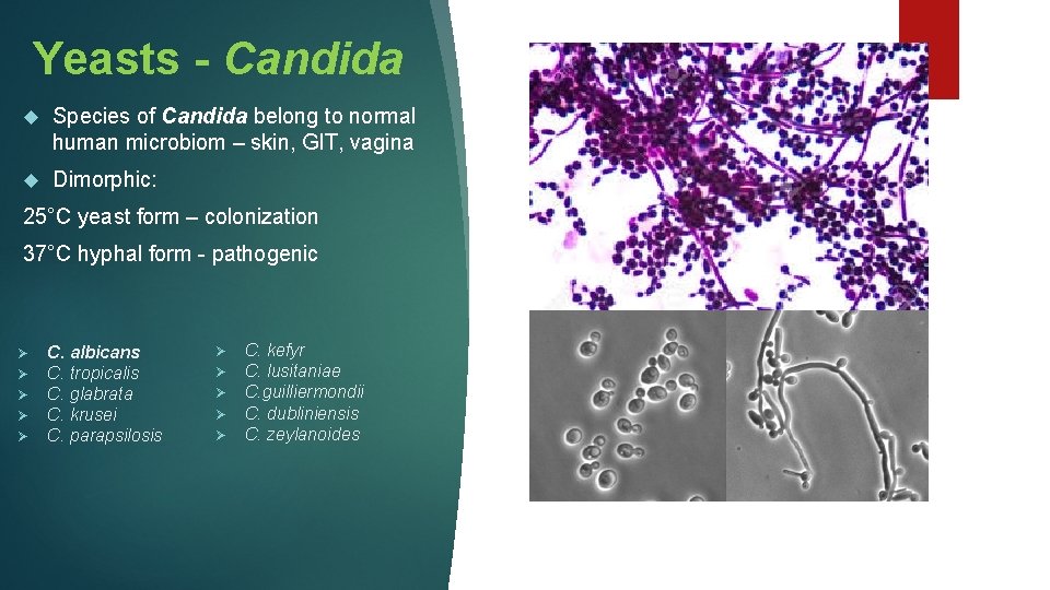 Yeasts - Candida Species of Candida belong to normal human microbiom – skin, GIT,