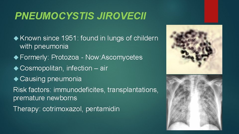 PNEUMOCYSTIS JIROVECII Known since 1951: found in lungs of childern with pneumonia Formerly: Protozoa