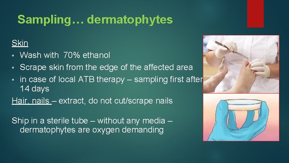 Sampling… dermatophytes Skin • Wash with 70% ethanol • Scrape skin from the edge