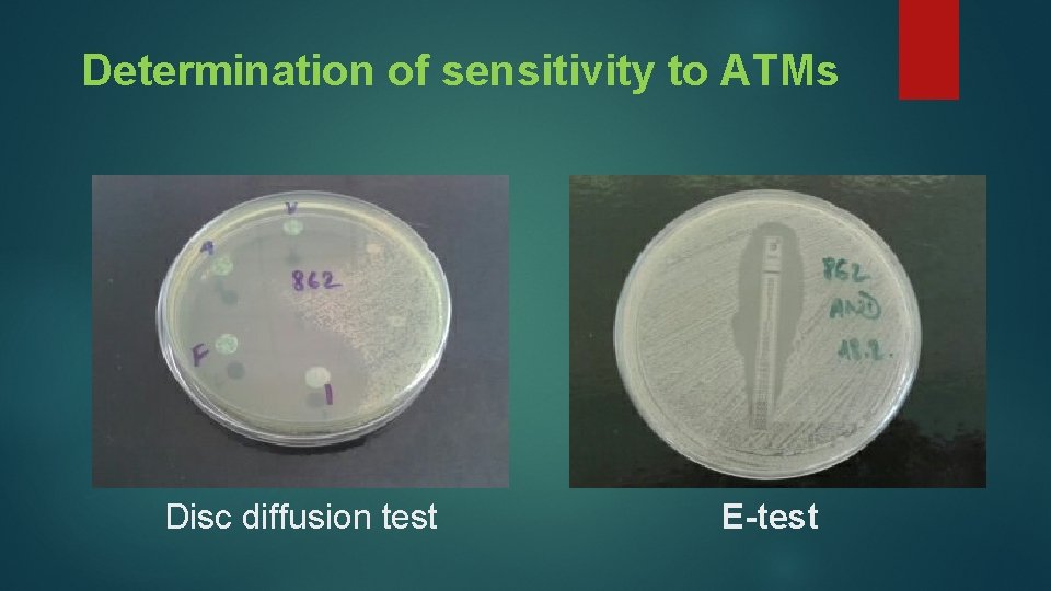 Determination of sensitivity to ATMs Disc diffusion test E-test 