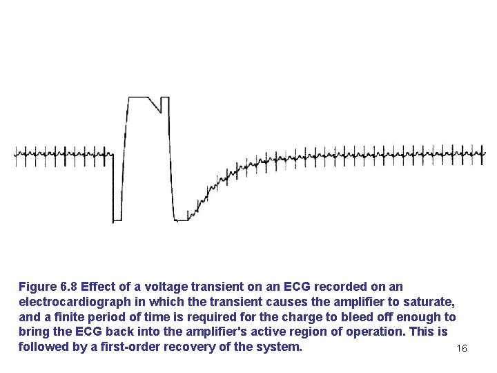 Figure 6. 8 Effect of a voltage transient on an ECG recorded on an