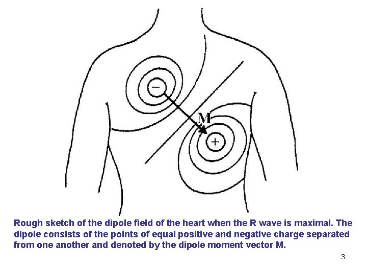 Rough sketch of the dipole field of the heart when the R wave is
