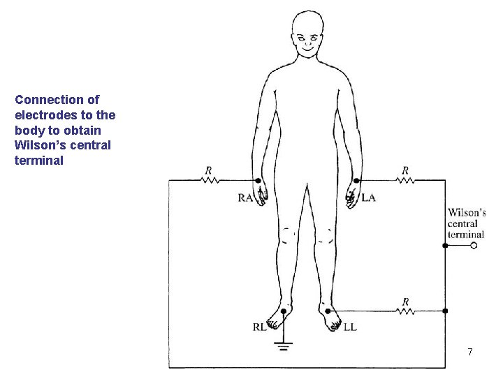 Connection of electrodes to the body to obtain Wilson’s central terminal 7 