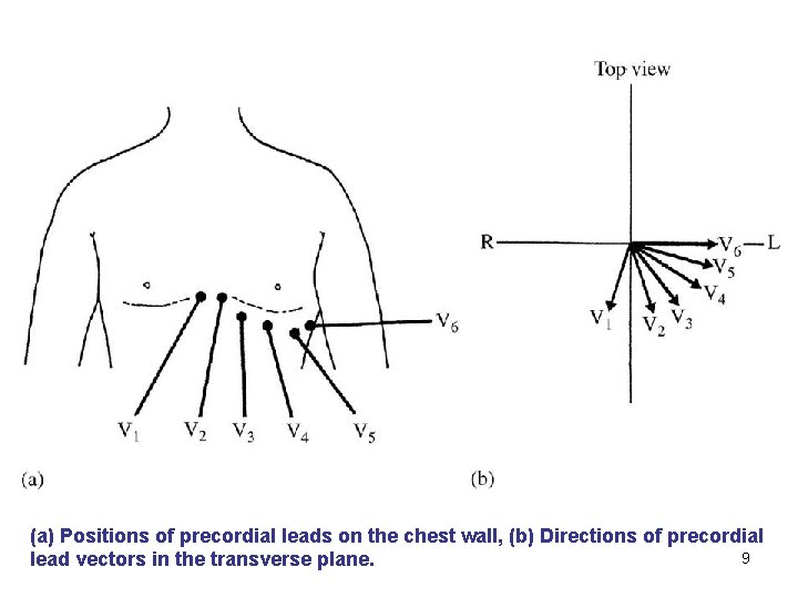 (a) Positions of precordial leads on the chest wall, (b) Directions of precordial 9