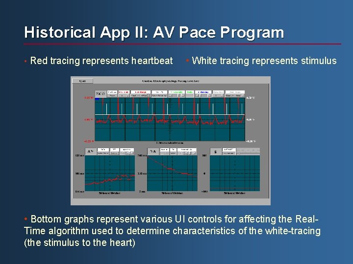 Historical App II: AV Pace Program • Red tracing represents heartbeat • White tracing