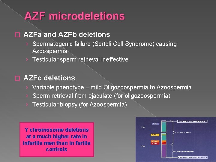 AZF microdeletions � AZFa and AZFb deletions › Spermatogenic failure (Sertoli Cell Syndrome) causing