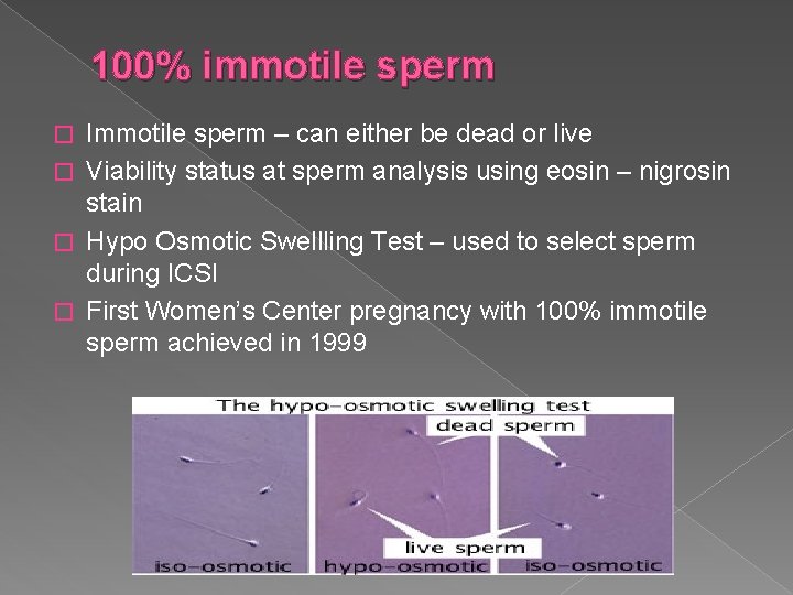 100% immotile sperm Immotile sperm – can either be dead or live � Viability