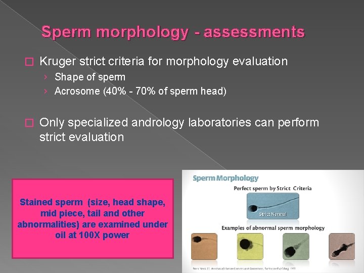 Sperm morphology - assessments � Kruger strict criteria for morphology evaluation › Shape of