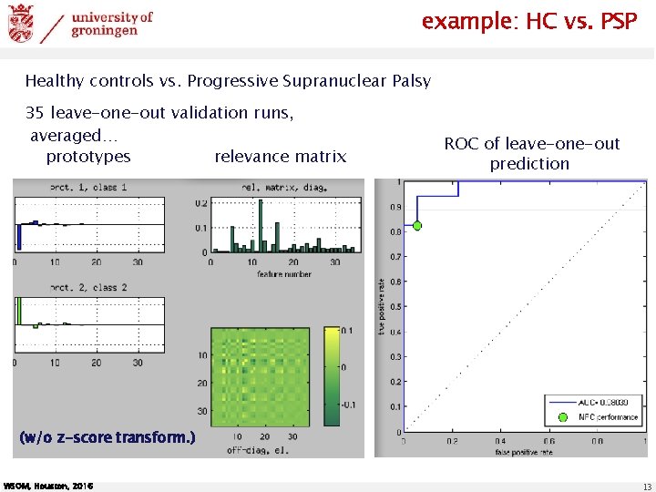 example: HC vs. PSP Healthy controls vs. Progressive Supranuclear Palsy 35 leave-one-out validation runs,