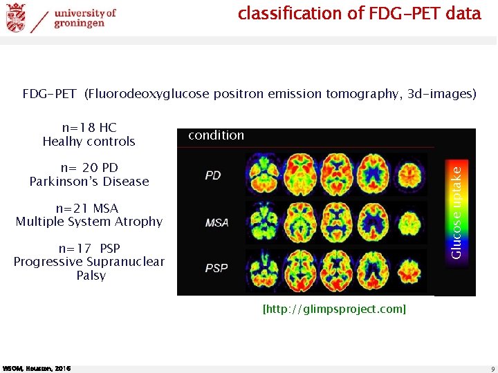 classification of FDG-PET data FDG-PET (Fluorodeoxyglucose positron emission tomography, 3 d-images) n=18 HC Healhy