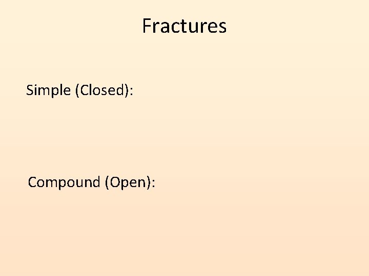 Fractures Simple (Closed): Compound (Open): 