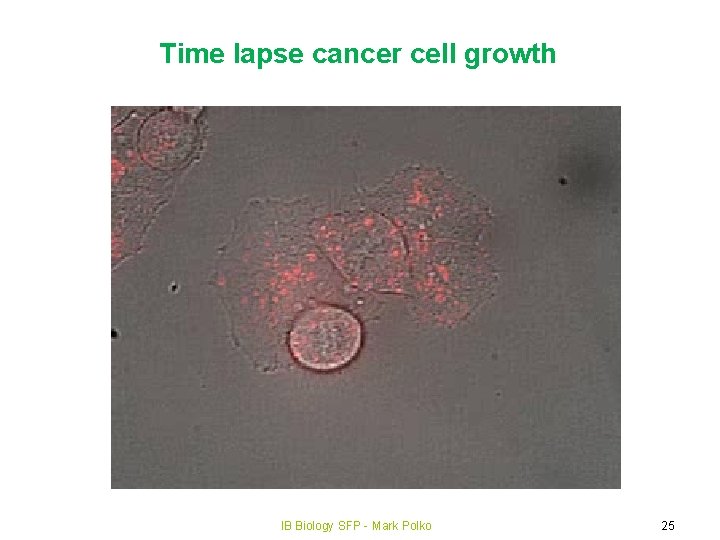 Time lapse cancer cell growth IB Biology SFP - Mark Polko 25 