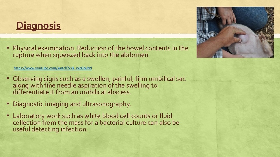 Diagnosis ▪ Physical examination. Reduction of the bowel contents in the rupture when squeezed