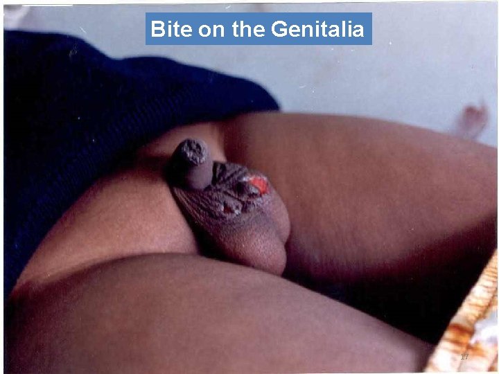 Bite on the Genitalia 17 
