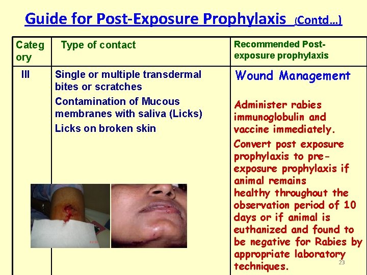 Guide for Post-Exposure Prophylaxis Categ ory III Type of contact Single or multiple transdermal