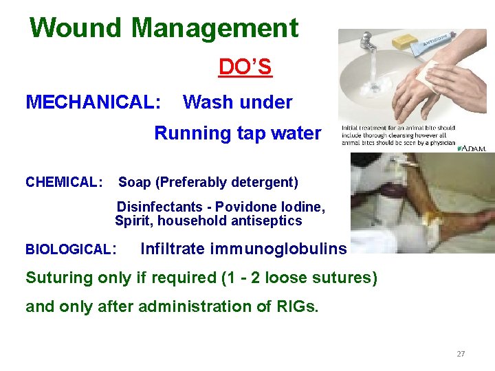 Wound Management DO’S MECHANICAL: Wash under Running tap water CHEMICAL: Soap (Preferably detergent) Disinfectants
