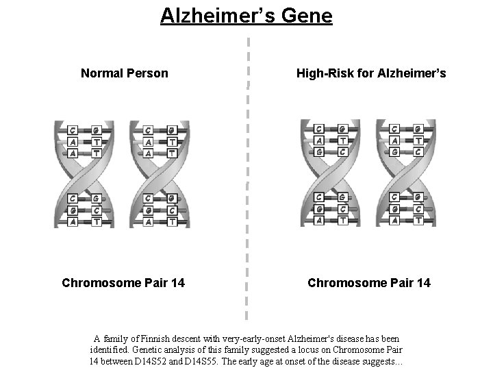 Alzheimer’s Gene Normal Person High-Risk for Alzheimer’s Chromosome Pair 14 A family of Finnish