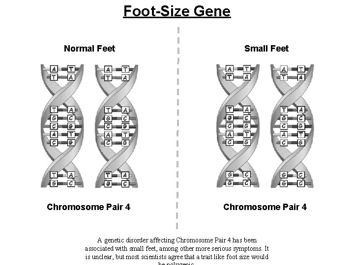 Foot-Size Gene Normal Feet Small Feet Chromosome Pair 4 A genetic disorder affecting Chromosome