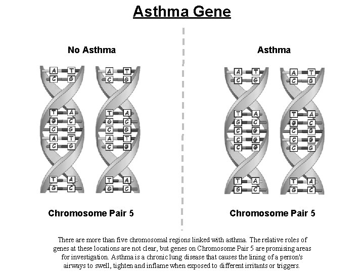 Asthma Gene No Asthma Chromosome Pair 5 There are more than five chromosomal regions