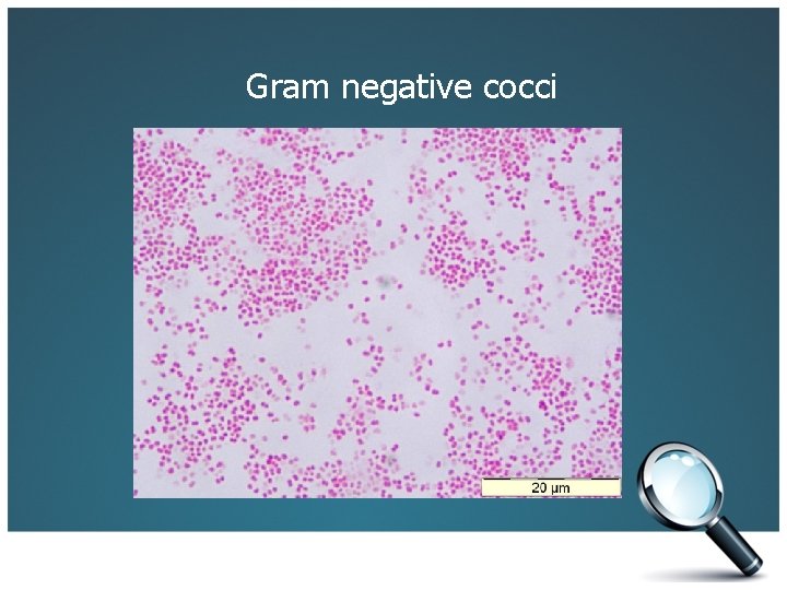 Gram negative cocci 