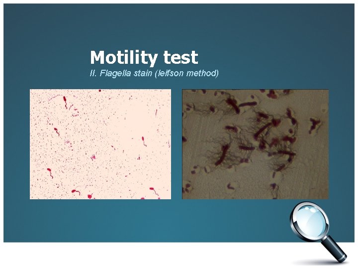 Motility test II. Flagella stain (leifson method) 