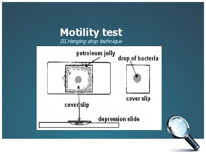 Motility test III. Hanging drop technique 