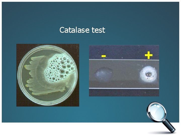 Catalase test 