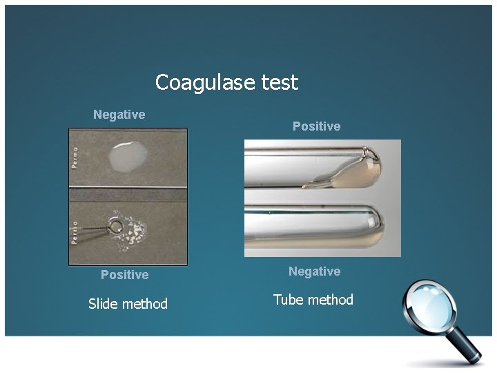 Coagulase test Negative Positive Slide method Positive Negative Tube method 