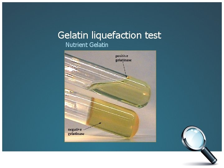 Gelatin liquefaction test Nutrient Gelatin 