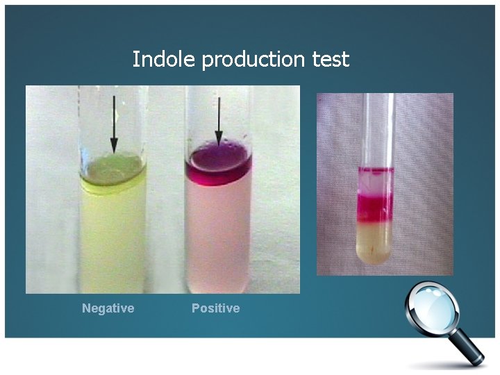 Indole production test Negative Positive 