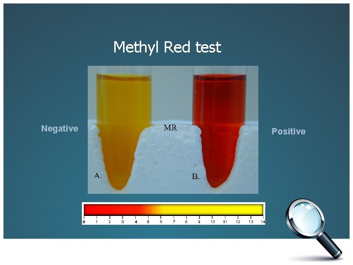 Methyl Red test Negative Positive 