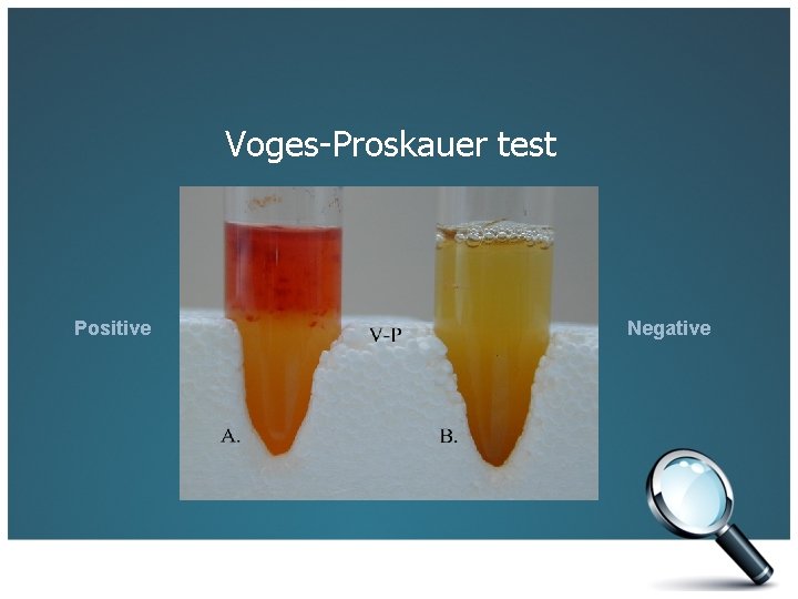Voges-Proskauer test Positive Negative 