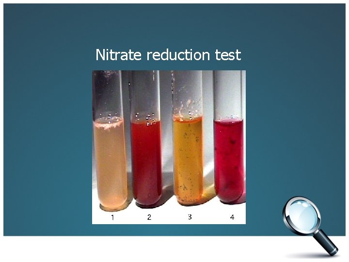 Nitrate reduction test 