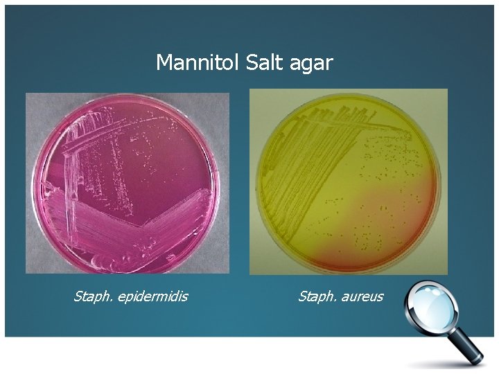 Mannitol Salt agar Staph. epidermidis Staph. aureus 