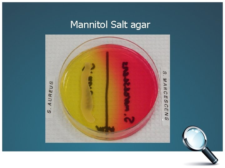 Mannitol Salt agar 